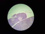 MISSING THUMBNAIL